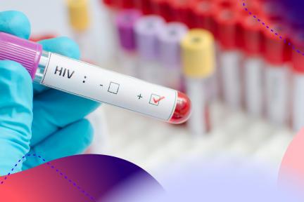 hiv de vergten epidemie